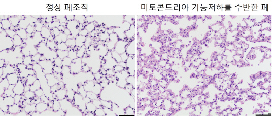 국내외 공동 연구진이 미토콘드리아가 세포 내 에너지 생산 기능 외에 세포의 기능과 분화를 조절하는 신호전달 기능이 있음을 밝혀냈다. 사진은 미토콘드리아 기능 저하에 따른 쥐의 폐조직 변화   연구재단 제공